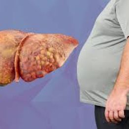 Жировая болезнь печени: что делать, когда печень "заплыла жиром"